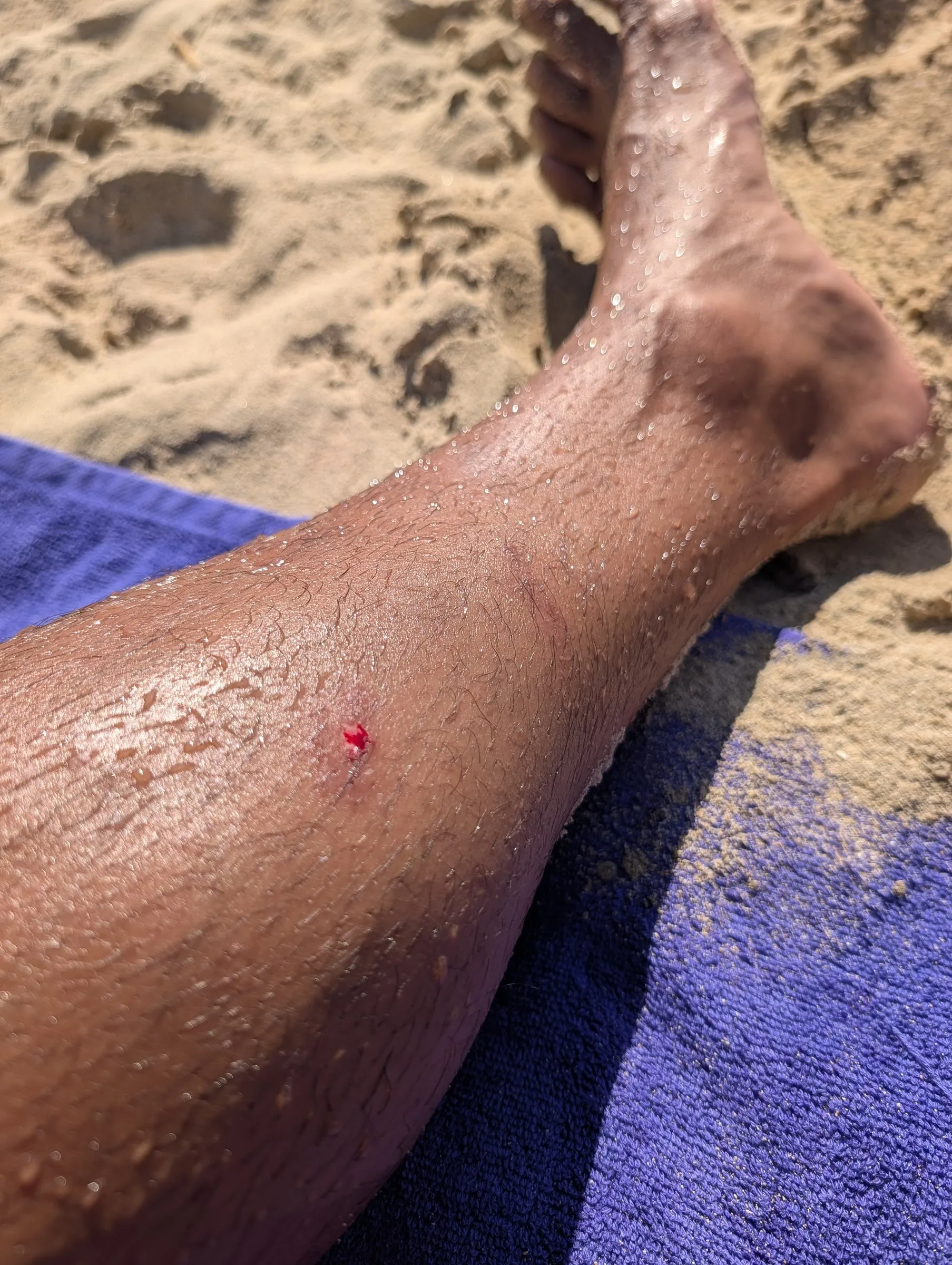 The scrape on my calf after something nipped it